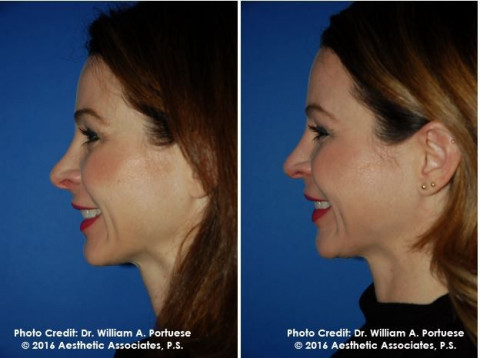 Visit The Portland Center for Facial Plastic Surgery